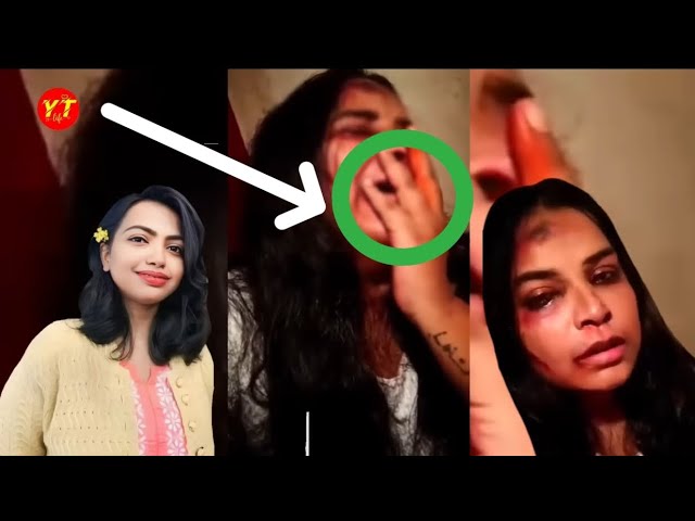 Moumita Original YouTube Viral Video Link , Dr Moumita Debnath Viral Video Link